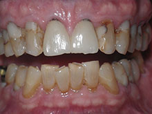 John Wells Before
